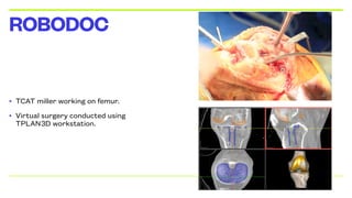 • TCAT miller working on femur.
• Virtual surgery conducted using
TPLAN3D workstation.
ROBODOC
 