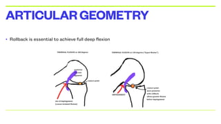 • Rollback is essential to achieve full deep flexion
ARTICULARGEOMETRY
 