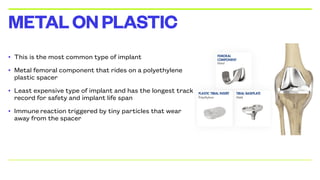 • This is the most common type of implant
• Metal femoral component that rides on a polyethylene
plastic spacer
• Least expensive type of implant and has the longest track
record for safety and implant life span
• Immune reaction triggered by tiny particles that wear
away from the spacer
METALONPLASTIC
 