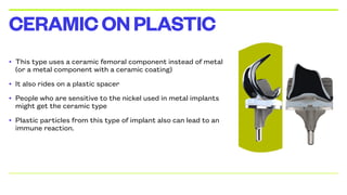 • This type uses a ceramic femoral component instead of metal
(or a metal component with a ceramic coating)
• It also rides on a plastic spacer
• People who are sensitive to the nickel used in metal implants
might get the ceramic type
• Plastic particles from this type of implant also can lead to an
immune reaction.
CERAMICONPLASTIC
 