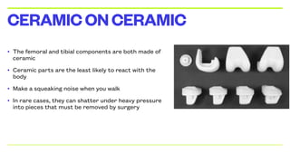 • The femoral and tibial components are both made of
ceramic
• Ceramic parts are the least likely to react with the
body
• Make a squeaking noise when you walk
• In rare cases, they can shatter under heavy pressure
into pieces that must be removed by surgery
CERAMICONCERAMIC
 