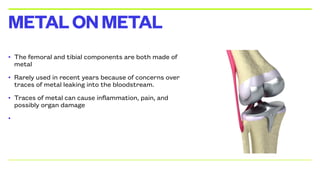 • The femoral and tibial components are both made of
metal
• Rarely used in recent years because of concerns over
traces of metal leaking into the bloodstream.
• Traces of metal can cause inflammation, pain, and
possibly organ damage
•
METALONMETAL
 