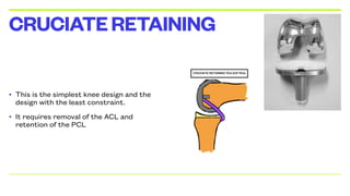 • This is the simplest knee design and the
design with the least constraint.
• It requires removal of the ACL and
retention of the PCL
CRUCIATERETAINING
 