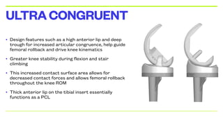 • Design features such as a high anterior lip and deep
trough for increased articular congruence, help guide
femoral rollback and drive knee kinematics
• Greater knee stability during flexion and stair
climbing
• This increased contact surface area allows for
decreased contact forces and allows femoral rollback
throughout the knee ROM
• Thick anterior lip on the tibial insert essentially
functions as a PCL
ULTRACONGRUENT
 