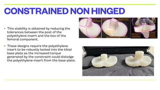 • This stability is obtained by reducing the
tolerances between the post of the
polyethylene insert and the box of the
femoral component.
• These designs require the polyethylene
insert to be robustly locked into the tibial
base plate as the increased torque
generated by the constraint could dislodge
the polyethylene insert from the base-plate.
CONSTRAINEDNONHINGED
 