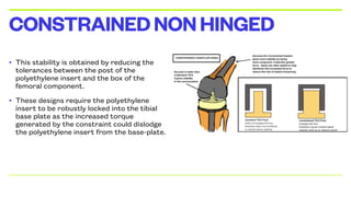 • This stability is obtained by reducing the
tolerances between the post of the
polyethylene insert and the box of the
femoral component.
• These designs require the polyethylene
insert to be robustly locked into the tibial
base plate as the increased torque
generated by the constraint could dislodge
the polyethylene insert from the base-plate.
CONSTRAINEDNONHINGED
 