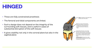 • These are fully constrained prosthesis
• The femoral and tibial components are linked.
• Such a design does not depend on the integrity of the
surrounding soft tissues, and is useful in cases of
substantial disruption of the soft tissues
• It gives stability not only in the coronal plane but also in the
sagittal plane
HINGED
 
