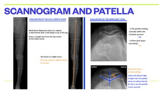 SCANNOGRAMANDPATELLA
 