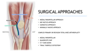 SURGICAL APPROACHES
• MEDIAL PARAPATELLAR APPROACH
• MID VASTUS APPROACH
• SUBVASTUS APPROACH
• MINIMALLY INASIVE APPROACH
COMPLEX PRIMARY OR REVISION TOTAL KNEE ARTHROPLASTY
• MEDIAL PARAPATELLAR
• QUADRICEPS SNIP
• V-Y TURN DOWN
• TIBIAL TUBERCLE OSTEOTOMY
 