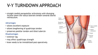 V-Y TURNDOWN APPROACH
• straight medial parapatellar arthrotomy with diverging
incision down the vastus lateralis tendon towards lateral
retinaculum.
Advantages
• allows excellent exposure
• allows lengthening of quadriceps tendon
• preserves patellar tendon and tibial tubercle
Disadvantages
• extensor lag
• may affect quadriceps strength
• knee needs to be immobilized post-operatively
 