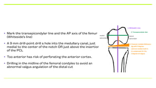 • Mark the transepicondylar line and the AP axis of the femur
(Whiteside’s line)
• A 9 mm drill-point drill a hole into the medullary canal, just
medial to the center of the notch OR just above the insertion
of the PCL
• Too anterior has risk of perforating the anterior cortex.
• Drilling in the midline of the femoral condyles to avoid an
abnormal valgus angulation of the distal cut
 