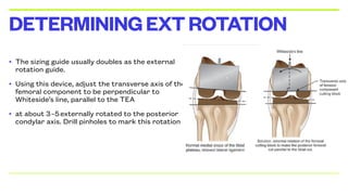 • The sizing guide usually doubles as the external
rotation guide.
• Using this device, adjust the transverse axis of the
femoral component to be perpendicular to
Whiteside’s line, parallel to the TEA
• at about 3o
–5o
externally rotated to the posterior
condylar axis. Drill pinholes to mark this rotation
DETERMININGEXTROTATION
 