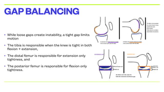 • While loose gaps create instability, a tight gap limits
motion
• The tibia is responsible when the knee is tight in both
flexion + extension,
• The distal femur is responsible for extension only
tightness, and
• The posterior femur is responsible for flexion only
tightness.
GAPBALANCING
 