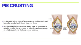 • In varus or valgus knee after assessment pie crusting of
lateral or medial soft tissue sleeve is done.
• Multiple stab incisions with scalpel blade or large needle
parallel to joint line are made to effectively elongate areas
of soft tissue sleeve that are under tension.
PIECRUSTING
 