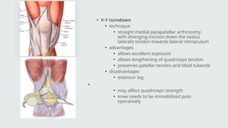 TKR for beginners arthroplasty final .pptx