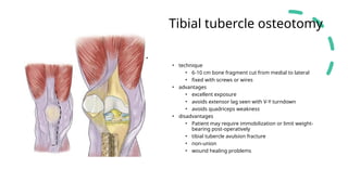 TKR for beginners arthroplasty final .pptx