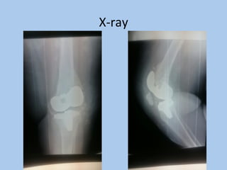 X-ray	
 