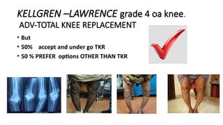 TKR[total knee replacement]-SURGERY OF THE CENTURY DR MOHAMED ASHRAF ...