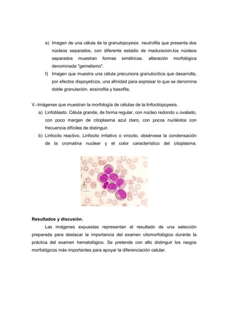 e) Imagen de una célula de la granulopoyesis neutrofila que presenta dos
          núcleos separados, con diferente estadio de maduracion.los núcleos
          separados     muestran     formas   simétricas.   alteración   morfológica
          denominada "gemelismo".
      f) Imagen que muestra una célula precursora granulocitica que desarrolla,
          por efectos dispoyeticos, una afinidad para expresar lo que se denomina
          doble granulación. eosinofila y basofila.


V.-Imágenes que muestran la morfología de células de la linfocitopoyesis.
   a) Linfoblasto. Célula grande, de forma regular, con núcleo redondo u ovalado,
      con poco margen de citoplasma azul claro, con pocos nucléolos con
      frecuencia difíciles de distinguir.
   b) Linfocito reactivo. Linfocito irritativo o virocito. obsérvese la condensación
      de la cromatina nuclear y el color característico del citoplasma.




Resultados y discusión.
      Las imágenes expuestas representan el resultado de una selección
preparada para destacar la importancia del examen citomorfológico durante la
práctica del examen hematológico. Se pretende con ello distinguir los rasgos
morfológicos más importantes para apoyar la diferenciación celular.
 