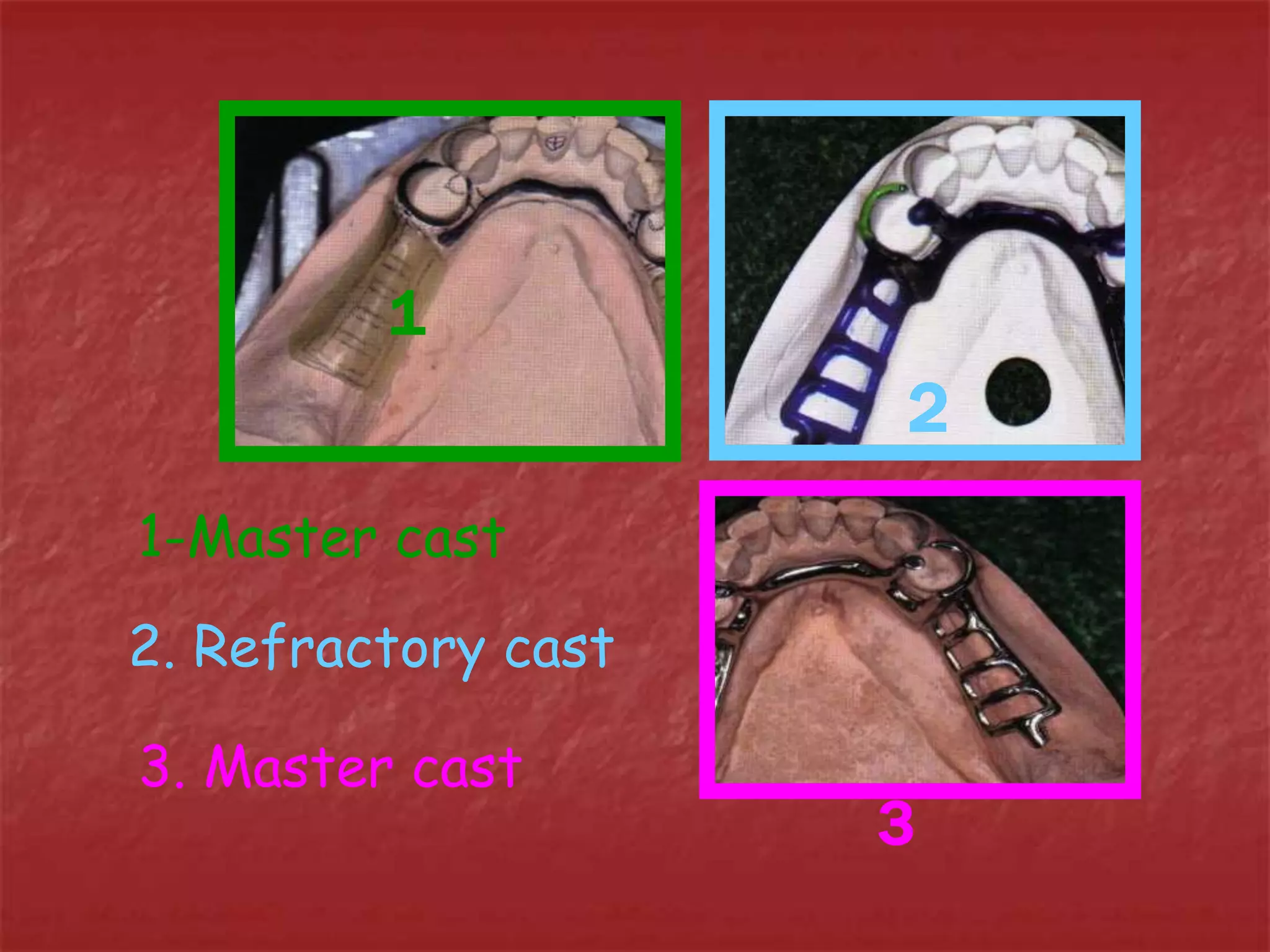 1 
2 
3 
1-Master cast 
2. Refractory cast 
3. Master cast 
 