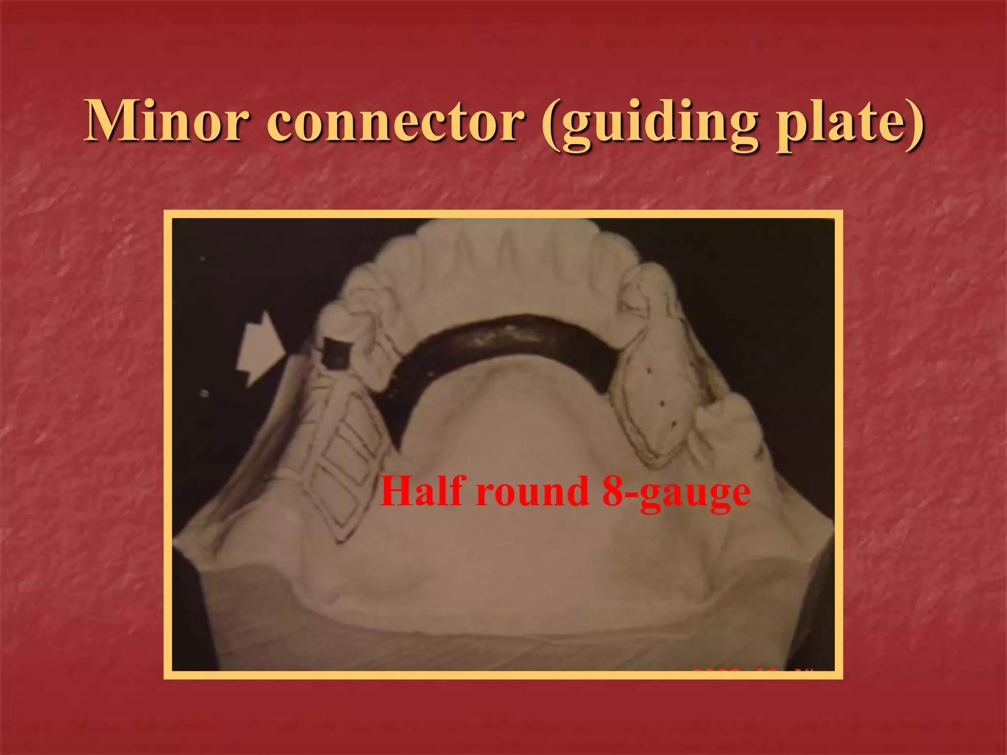 Minor connector (guiding plate) 
Half round 8-gauge 
 