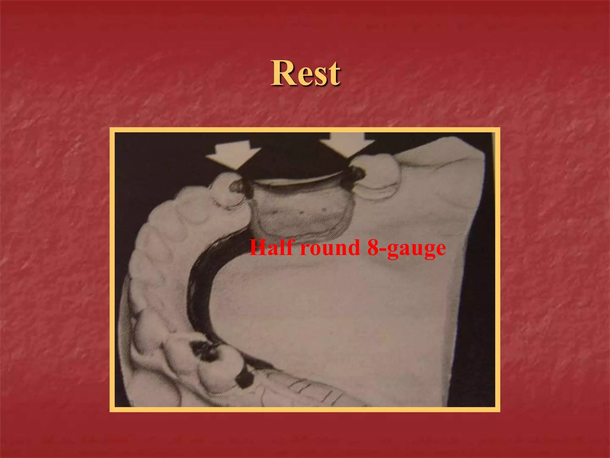 Rest 
Half round 8-gauge 
 