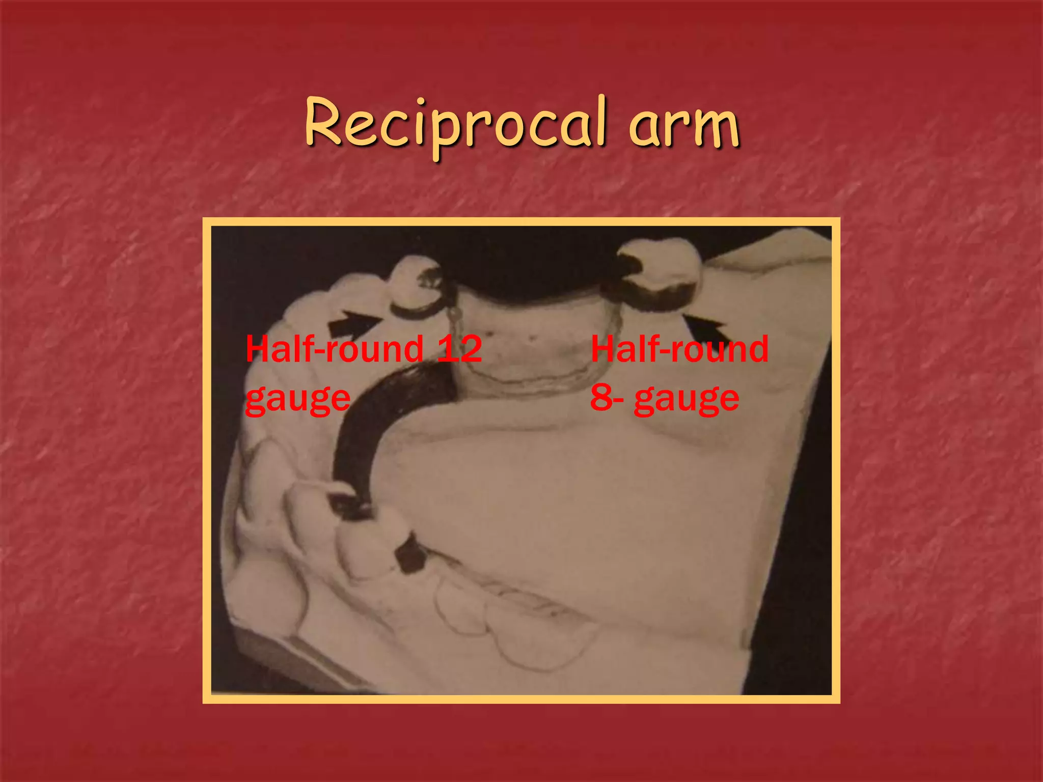 Reciprocal arm 
Half-round 12 
gauge 
Half-round 
8- gauge 
 