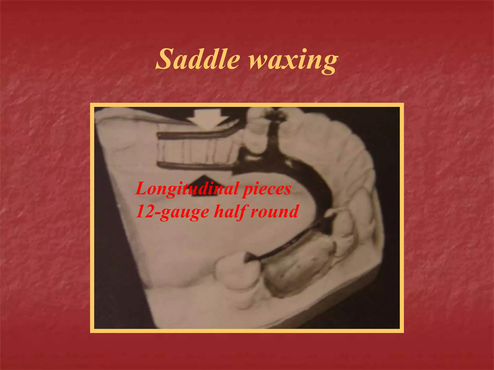 Saddle waxing 
Longitudinal pieces 
12-gauge half round 
 
