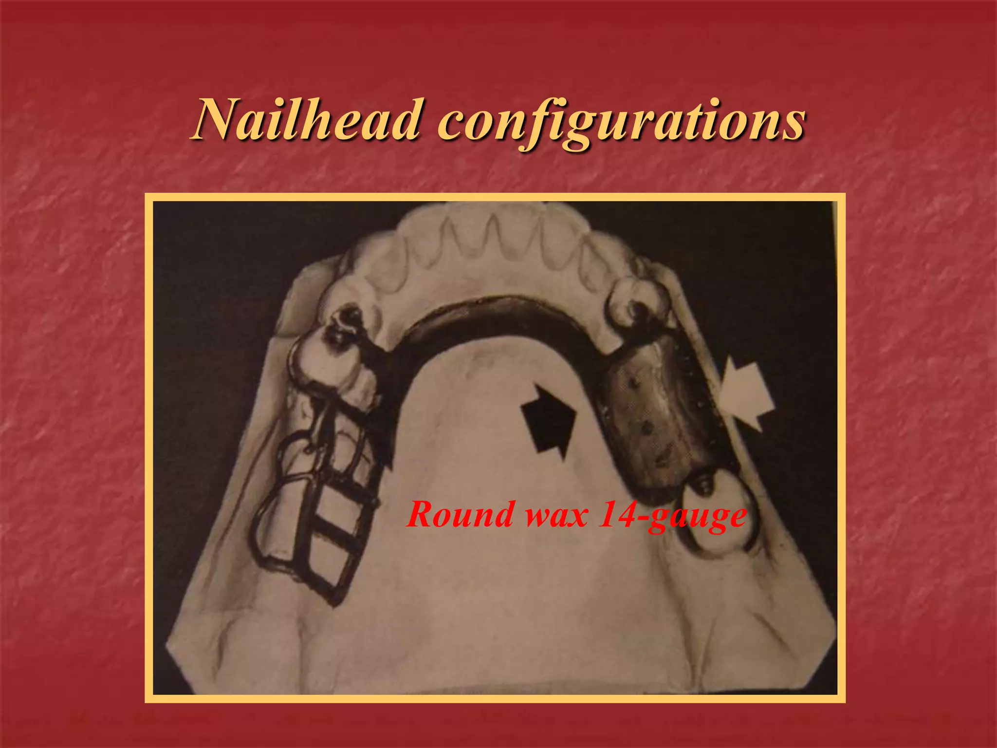 Nailhead configurations 
Round wax 14-gauge 
 