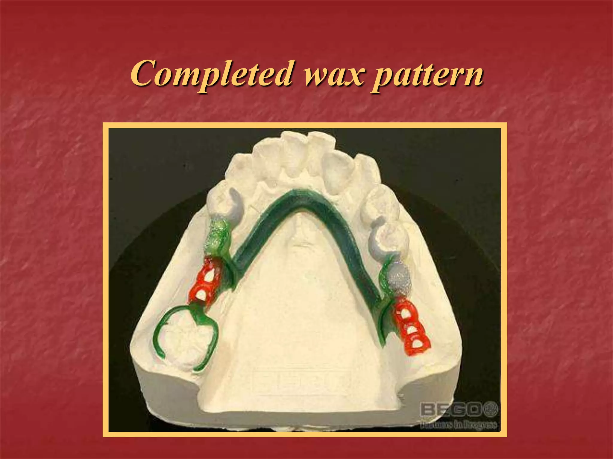 Completed wax pattern 
 