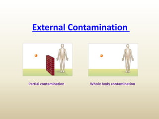 External Contamination
Partial contamination Whole body contamination
 