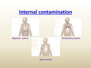 Internal contamination
Digestive system Respiratory system
Open wound
 