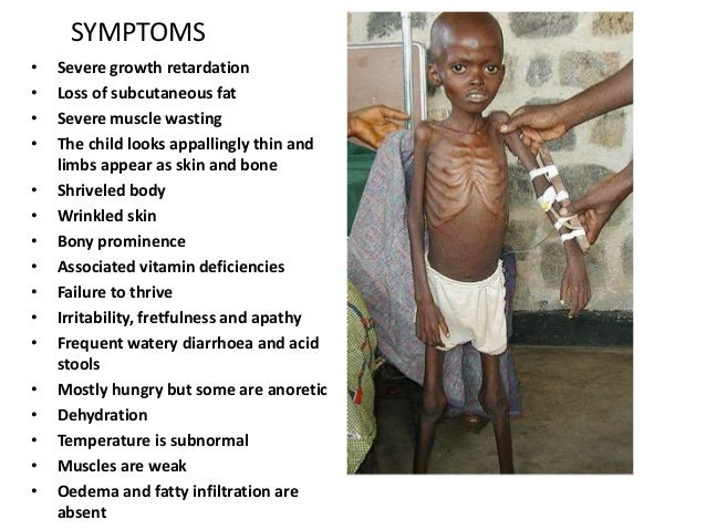 1.malnutrition