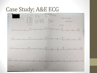 Case Study; A&E ECG
 