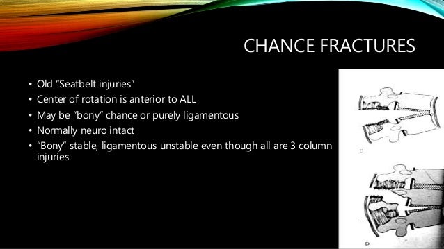 Thoraco Lumbar Spine Injury