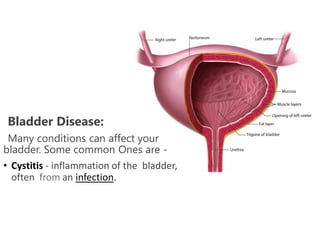 Bladder Disease:
Many conditions can affect your
bladder. Some common Ones are -
• Cystitis - inflammation of the bladder,
often from an infection.
 