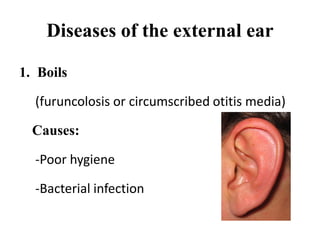 Diseases of the external ear
1. Boils
(furuncolosis or circumscribed otitis media)
Causes:
-Poor hygiene
-Bacterial infection
 