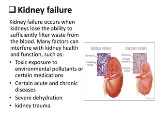 Kidney failure
Kidney failure occurs when
kidneys lose the ability to
sufficiently filter waste from
the blood. Many factors can
interfere with kidney health
and function, such as:
• Toxic exposure to
environmental pollutants or
certain medications
• Certain acute and chronic
diseases
• Severe dehydration
• kidney trauma
 