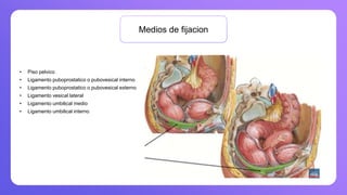 Medios de fijacion
• Piso pelvico
• Ligamento puboprostatico o pubovesical interno
• Ligamento puboprostatico o pubovesical externo
• Ligamento vesical lateral
• Ligamento umbilical medio
• Ligamento umbilical interno
 