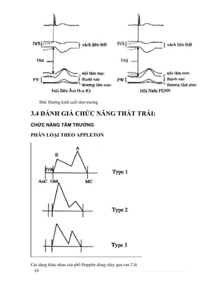 Dtd: Đường kính cuối tâm trương 
3.4 ĐÁNH GIÁ CHỨC NĂNG THẤT TRÁI: 
CHỨC NĂNG TÂM TRƯƠNG 
PHÂN LOẠI THEO APPLETON 
Các dạng khác nhau của phổ Doppler dòng chảy qua van 2 lá 
10 http://www.ebook.edu.vn 
 