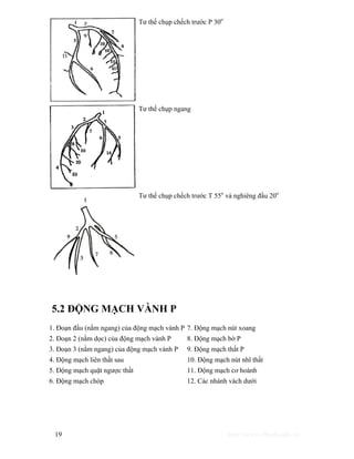 Tư thế chụp chếch trước P 30o 
Tư thế chụp ngang 
Tư thế chụp chếch trước T 55o và nghiêng đầu 20o 
5.2 ĐỘNG MẠCH VÀNH P 
1. Đoạn đầu (nằm ngang) của động mạch vành P 7. Động mạch nút xoang 
2. Đoạn 2 (nằm dọc) của động mạch vành P 8. Động mạch bờ P 
3. Đoạn 3 (nằm ngang) của động mạch vành P 9. Động mạch thất P 
4. Động mạch liên thất sau 10. Động mạch nút nhĩ thất 
5. Động mạch quặt ngược thất 11. Động mạch cơ hoành 
6. Động mạch chóp 12. Các nhánh vách dưới 
19 http://www.ebook.edu.vn 
 