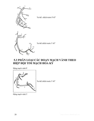 Tư thế chếch trước P 45o 
Tư thế chếch trước T 45o 
5.3 PHÂN LOẠI CÁC ĐOẠN MẠCH VÀNH THEO 
HIỆP HỘI TIM MẠCH HOA KỲ 
Động mạch vành P 
Tư thế chếch trước T 45o 
Động mạch vành T 
20 http://www.ebook.edu.vn 
 