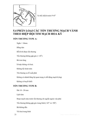 Tư thế chếch trước P 45o 
5.4 PHÂN LOẠI CÁC TỔN THƯƠNG MẠCH VÀNH 
THEO HIỆP HỘI TIM MẠCH HOA KỲ 
TỔN THƯƠNG TYPE A: 
Ngắn < 10mm 
Đồng tâm 
Dễ đi tới được tổn thương 
Tổn thương không gập góc (< 45o) 
Bờ trơn láng 
Ít hoặc không vôi hoá. 
Không tắc hoàn toàn 
Tôn thương xa lỗ xuất phát 
Không có nhánh bằng hệ quan trọng ở chỗ động mạch bị hẹp 
Không có huyết khối 
TỔN THƯƠNG TYPE B: 
Dài 10 - 20 mm 
Lệch tâm 
Đoạn mạch máu trước tổn thương chỉ ngoằn ngoèo vừa phải 
Tổn thương không gập góc trung bình (>45o và <90o) 
Bờ không đều 
Vôi hoá trung bình 
21 http://www.ebook.edu.vn 
 