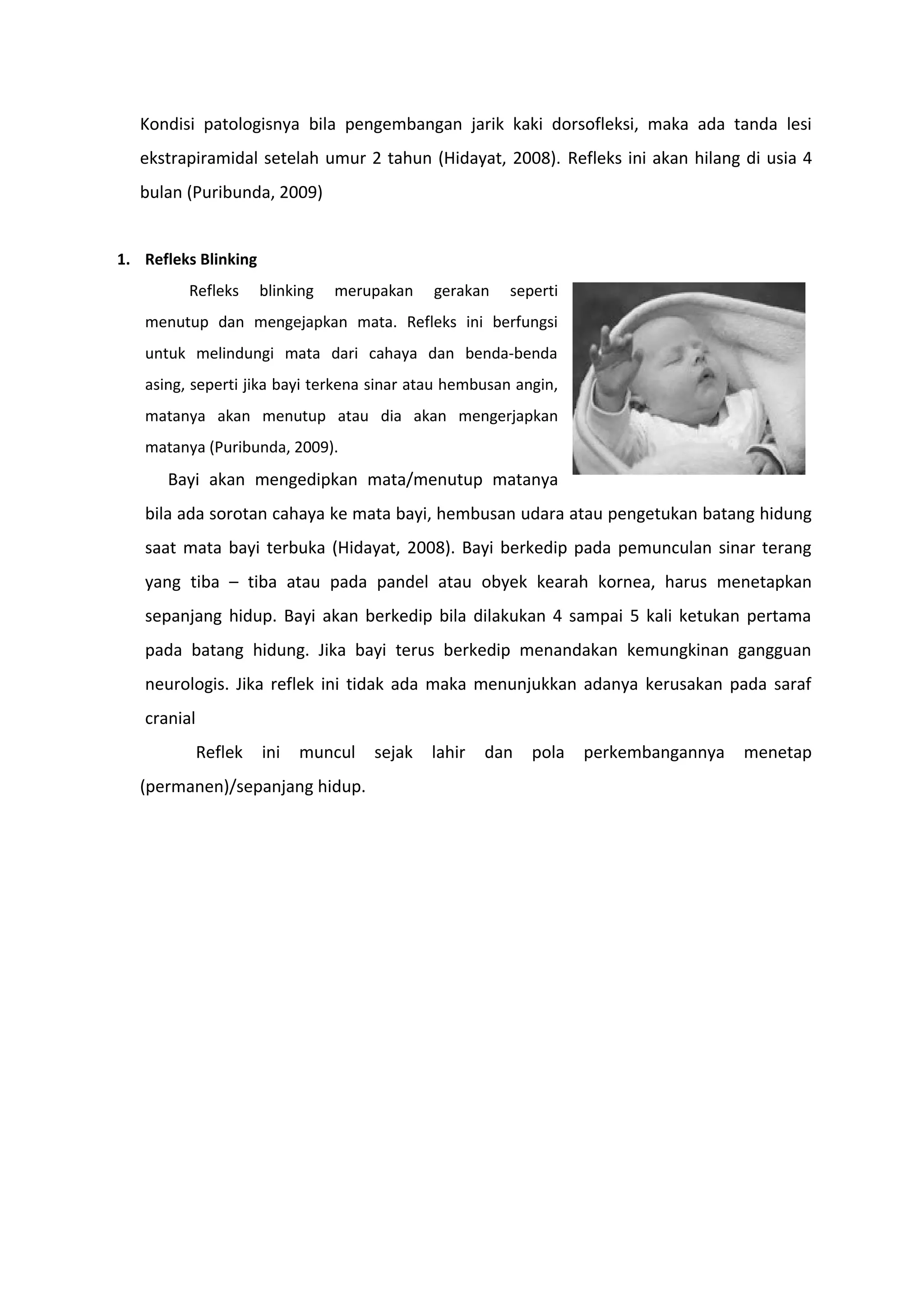 Kondisi patologisnya bila pengembangan jarik kaki dorsofleksi, maka ada tanda lesi
ekstrapiramidal setelah umur 2 tahun (Hidayat, 2008). Refleks ini akan hilang di usia 4
bulan (Puribunda, 2009)
1. Refleks Blinking
Refleks blinking merupakan gerakan seperti
menutup dan mengejapkan mata. Refleks ini berfungsi
untuk melindungi mata dari cahaya dan benda-benda
asing, seperti jika bayi terkena sinar atau hembusan angin,
matanya akan menutup atau dia akan mengerjapkan
matanya (Puribunda, 2009).
Bayi akan mengedipkan mata/menutup matanya
bila ada sorotan cahaya ke mata bayi, hembusan udara atau pengetukan batang hidung
saat mata bayi terbuka (Hidayat, 2008). Bayi berkedip pada pemunculan sinar terang
yang tiba – tiba atau pada pandel atau obyek kearah kornea, harus menetapkan
sepanjang hidup. Bayi akan berkedip bila dilakukan 4 sampai 5 kali ketukan pertama
pada batang hidung. Jika bayi terus berkedip menandakan kemungkinan gangguan
neurologis. Jika reflek ini tidak ada maka menunjukkan adanya kerusakan pada saraf
cranial
Reflek ini muncul sejak lahir dan pola perkembangannya menetap
(permanen)/sepanjang hidup.
 