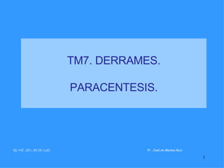 TM7. DERRAMES. PARACENTESIS. TG7 SNC.  LDC1.  IES JFC 05//07   Pr .   José de Medina Ruiz   