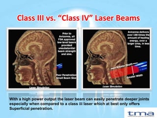TMA International — Class IV High Power Lasers — Laser Technology ...