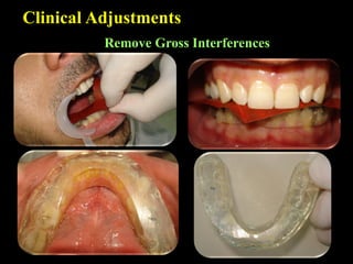 Clinical Adjustments
Remove Gross Interferences
 