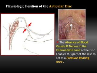 Physiologic Position of the Articular Disc
1
2
3
 The Absence of Blood
Vessels & Nerves in the
Intermediate Zone of the Disc
Enables this part of the disc to
act as a Pressure-Bearing
Area .
 