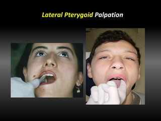 Lateral Pterygoid Palpation
 