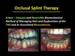 Occlusal Splint Therapy
A Non – invasive and Reversible Biomechanical
Method of Managing Pain and Dysfunction of the
TMJ and its Associated Musculatures .
 